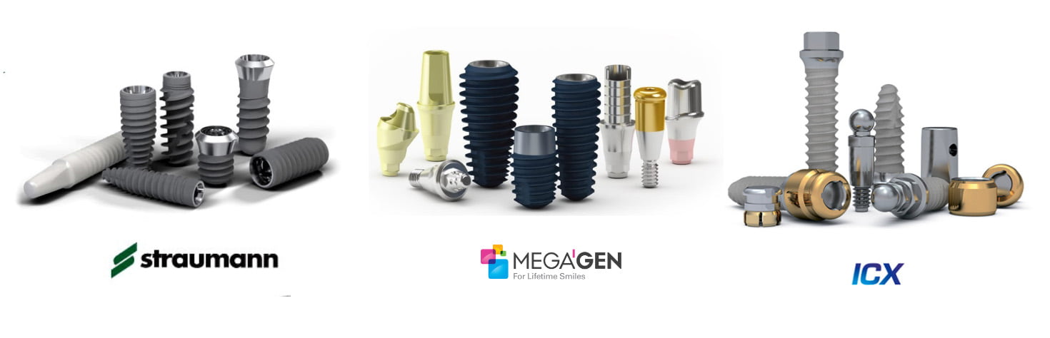 Які зубні імпланти краще ставити?